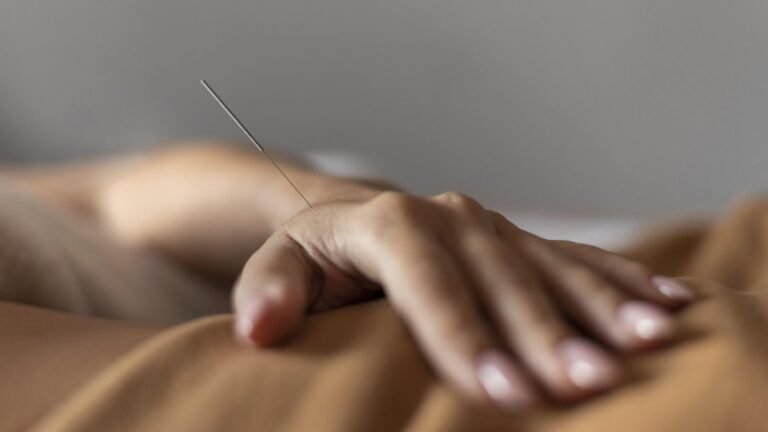 Acupuntura: quando essa abordagem pode ajudar em dor, ansiedade e sono