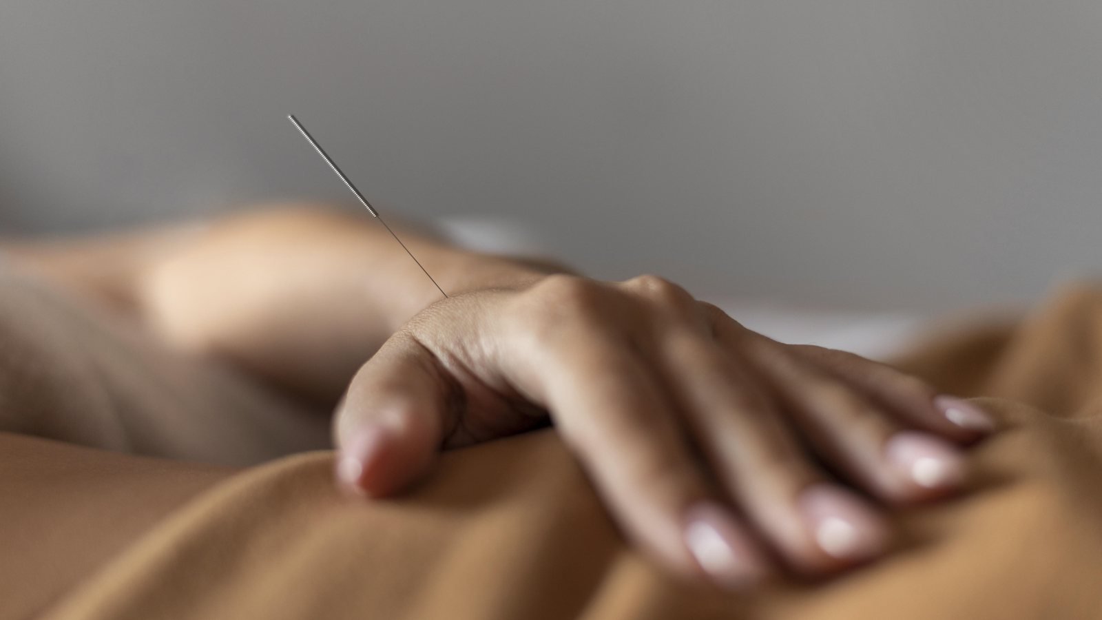 Acupuntura